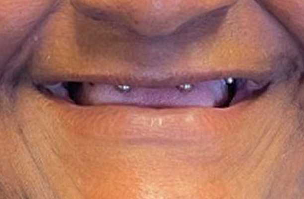 Before image