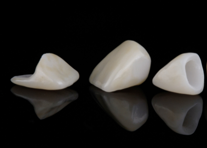 dental crowns at Citrus Smiles Dental Studio