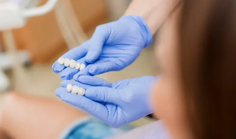 dental bridges