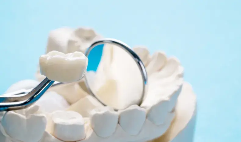 dental crowns
