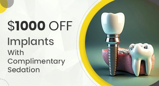 $1000 off implants with complimentary sedation