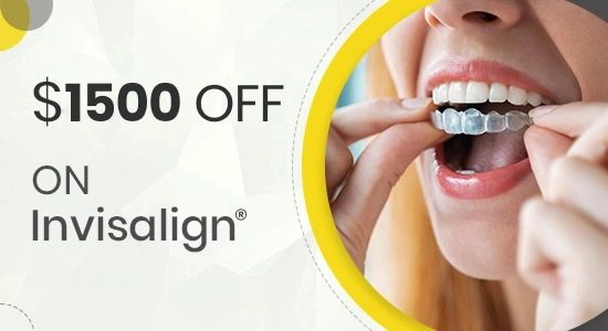 Invisalign special $1500 off