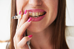 smoking and its effect on dental health