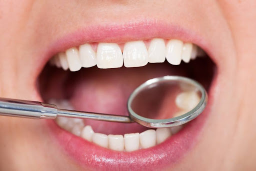 up close of a healthy smile