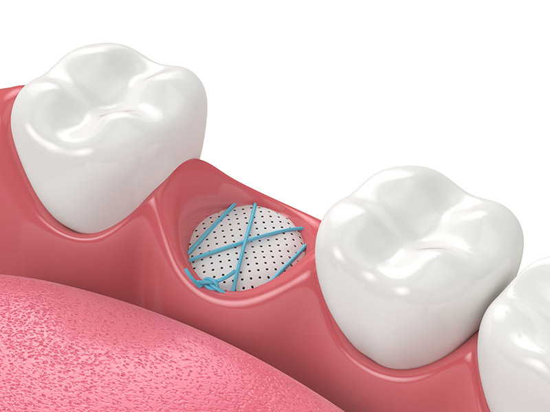 oral surgery at Citrus Smiles Dental Studio