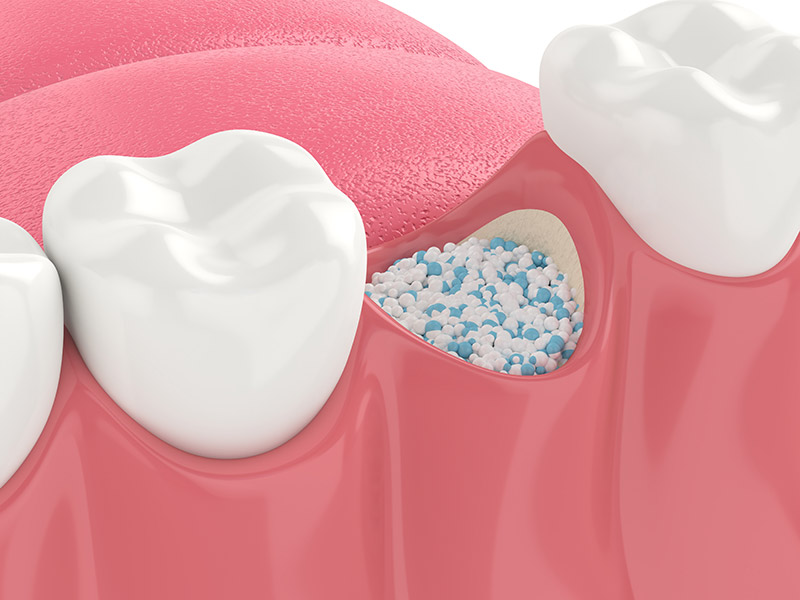 oral surgery at Citrus Smiles Dental Studio