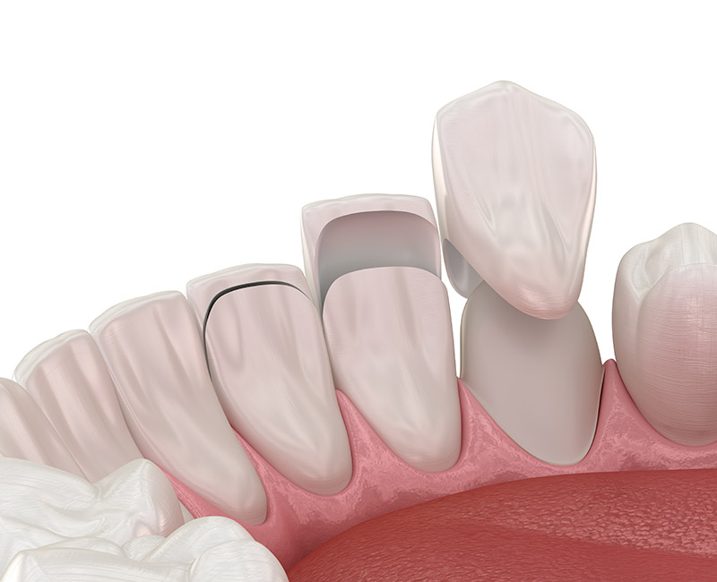 cosmetic dentistry at Citrus Smiles Dental Studio