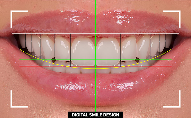 digital smile design at Citrus Smiles Dental Studio