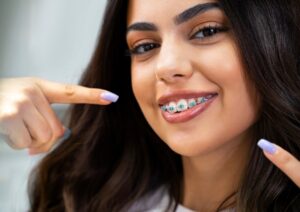 woman with adult braces