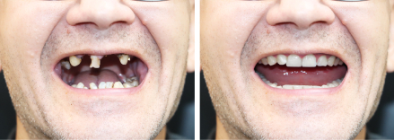 Before After