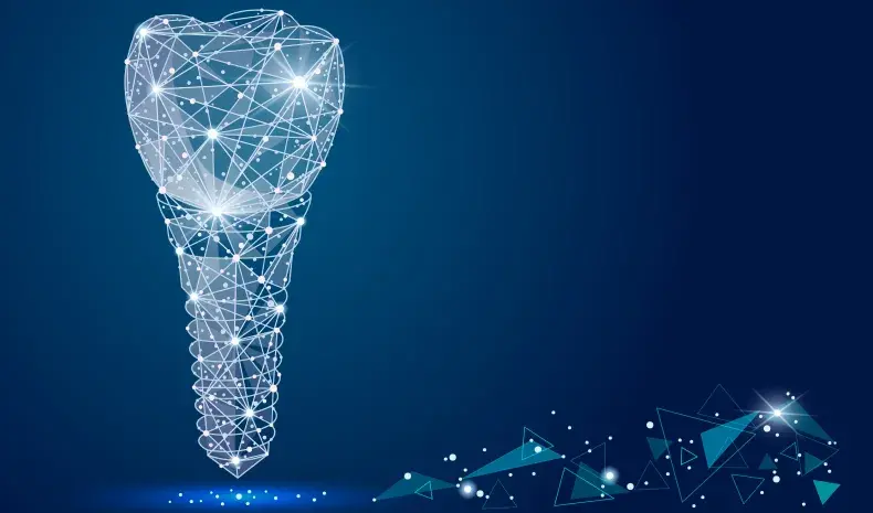 Computer-Guided Implants