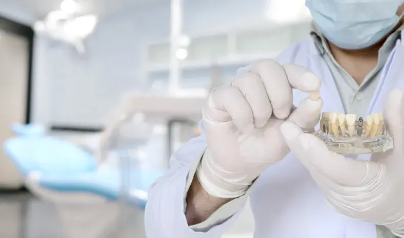 Dental Implants