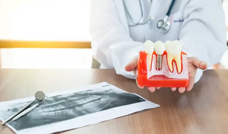 Digital X-rays