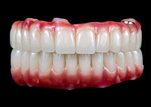 Permanent Zirconia Teeth Double Arch (All In)