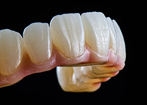 Permanent Zirconia Teeth Single Arch (All In)