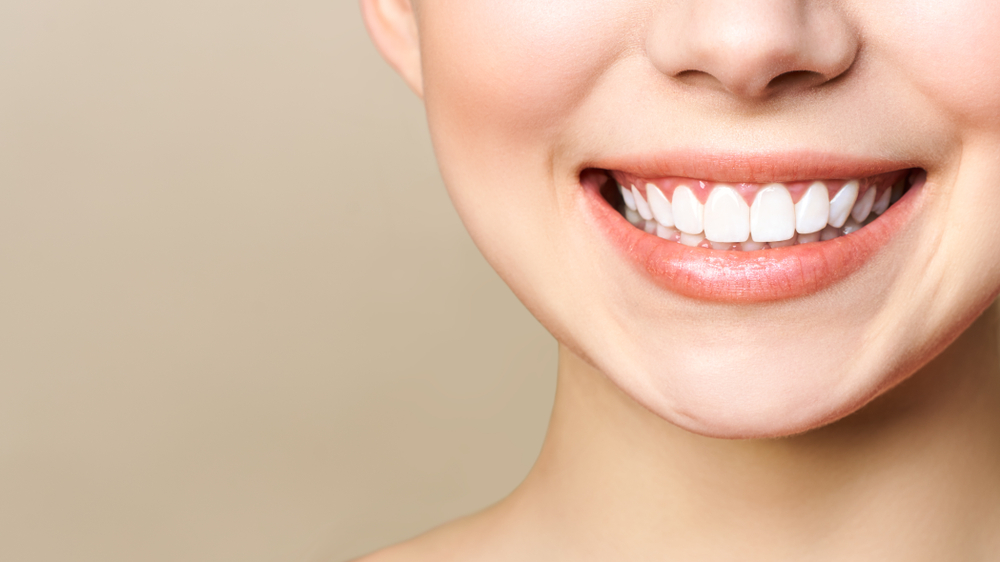 whitened smile