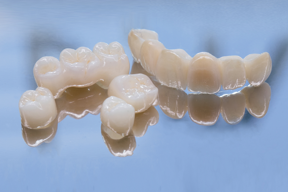 Metal,Free,Ceramic,Dental,Crowns.,Ceramic,Zirconium,In,Final,Version. dental bridges, crowns, and other restorations
