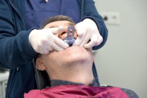 Dental professional placing a dental impression tray in a patient's mouth, illustrating modern dental practices for comfortable and accurate impressions.