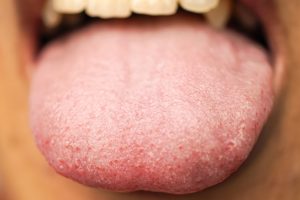 supertaster's tongue